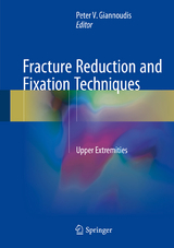 Fracture Reduction and Fixation Techniques - 