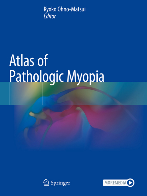 Atlas of Pathologic Myopia - 