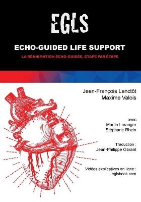 Echo Guided Life Support (EGLS) - Maxime Valois, Jean-François Lanctôt