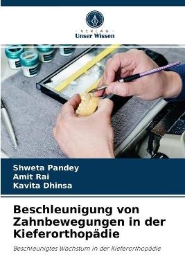 Beschleunigung von Zahnbewegungen in der Kieferorthopädie - Shweta Pandey, Amit Rai, Kavita Dhinsa