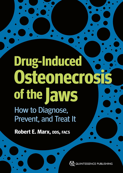 Drug-Induced Osteonecrosis of the Jaws - Robert E Marx