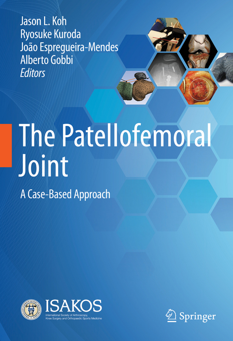 The Patellofemoral Joint - 