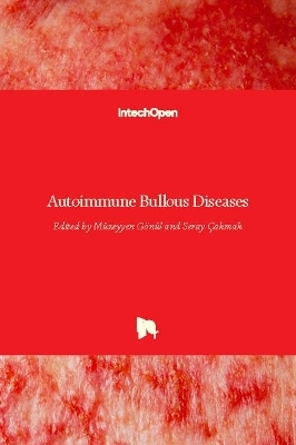 Autoimmune Bullous Diseases - 