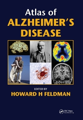 Atlas of Alzheimer's Disease - Howard Feldman