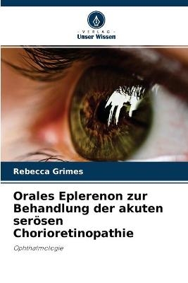 Orales Eplerenon zur Behandlung der akuten serösen Chorioretinopathie - Rebecca Grimes