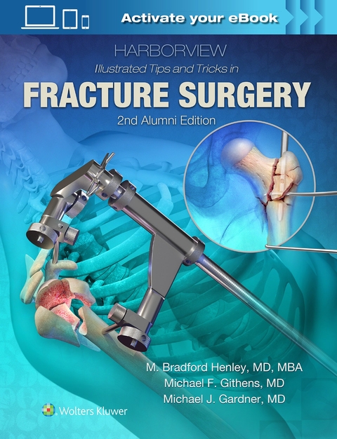 Harborview Illustrated Tips and Tricks in Fracture Surgery - M. Henley