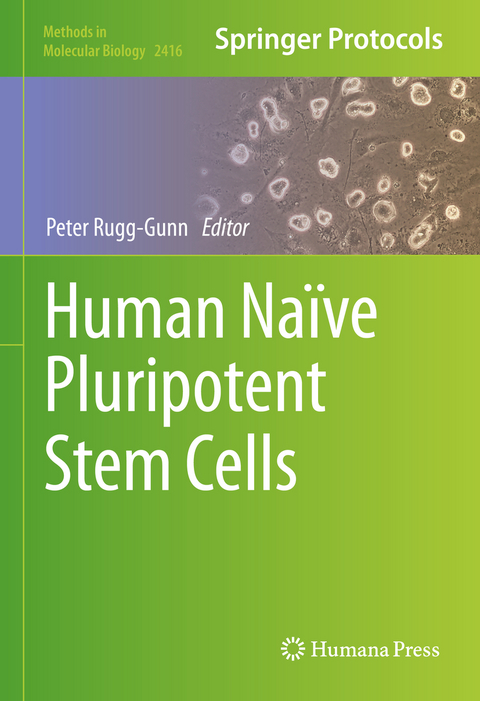 Human Naïve Pluripotent Stem Cells - 