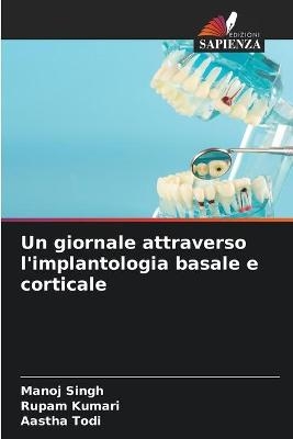 Un giornale attraverso l'implantologia basale e corticale - Manoj Singh, Rupam Kumari, Aastha Todi