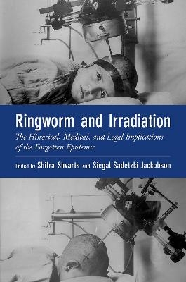 Ringworm and Irradiation - Shifra Shvarts, Siegal Sadetzki