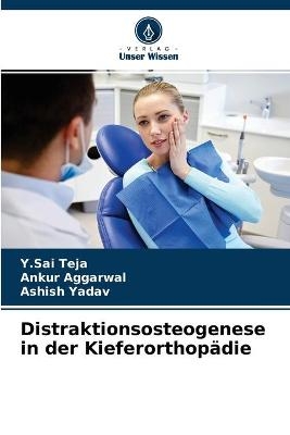 Distraktionsosteogenese in der Kieferorthopädie - Y Sai Teja, Ankur Aggarwal, Ashish Yadav