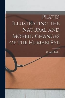 Plates Illustrating the Natural and Morbid Changes of the Human Eye - Charles Bader