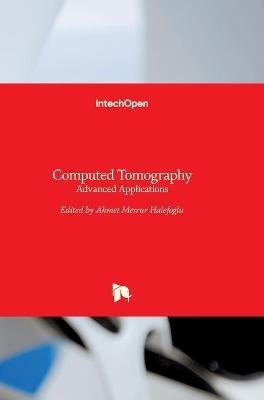 Computed Tomography - 