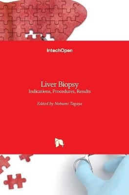 Liver Biopsy - 