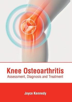 Knee Osteoarthritis: Assessment, Diagnosis and Treatment - 