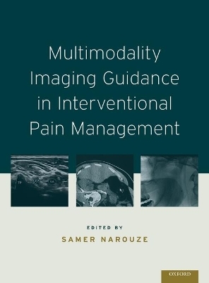 Multimodality Imaging Guidance in Interventional Pain Management - 