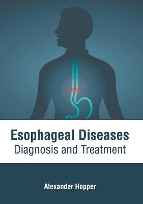 Esophageal Diseases: Diagnosis and Treatment - 