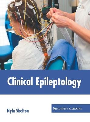 Clinical Epileptology - 