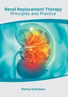 Renal Replacement Therapy: Principles and Practice - 