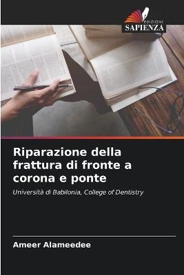 Riparazione della frattura di fronte a corona e ponte - Ameer Alameedee