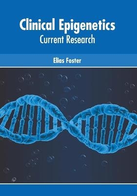 Clinical Epigenetics: Current Research - 