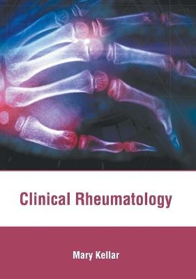 Clinical Rheumatology - 