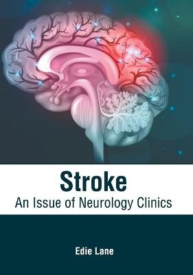 Stroke: An Issue of Neurology Clinics - 