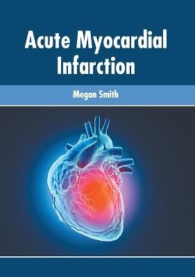 Acute Myocardial Infarction - 