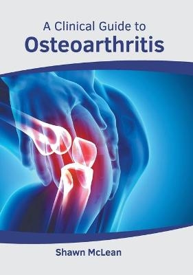 A Clinical Guide to Osteoarthritis - 