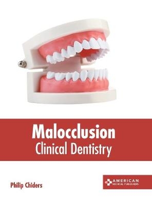 Malocclusion: Clinical Dentistry - 