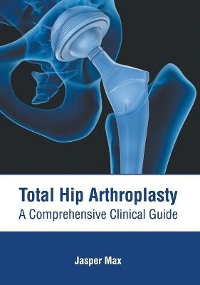 Total Hip Arthroplasty: A Comprehensive Clinical Guide - 