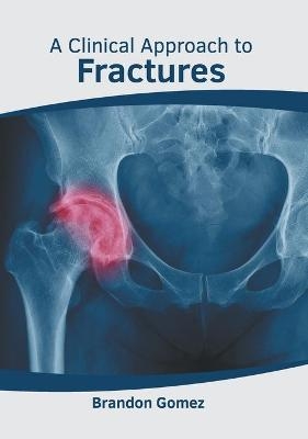 A Clinical Approach to Fractures - 