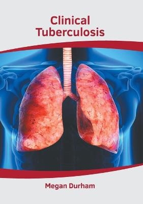 Clinical Tuberculosis - 