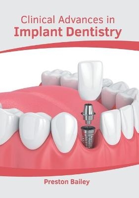 Clinical Advances in Implant Dentistry - 