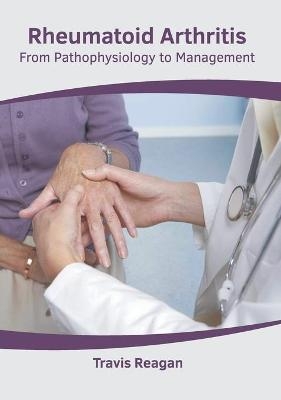 Rheumatoid Arthritis: From Pathophysiology to Management - 