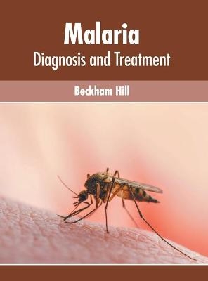 Malaria: Diagnosis and Treatment - 