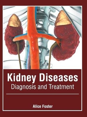 Kidney Diseases: Diagnosis and Treatment - 