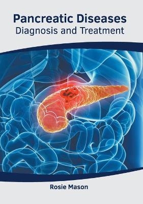 Pancreatic Diseases: Diagnosis and Treatment - 