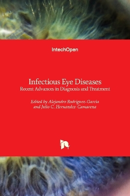 Infectious Eye Diseases - 