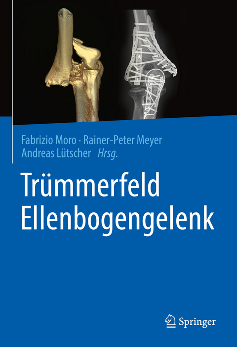 Trümmerfeld Ellenbogengelenk - 