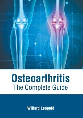 Osteoarthritis: The Complete Guide - 