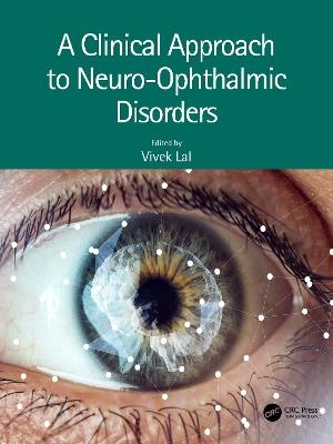 A Clinical Approach to Neuro-Ophthalmic Disorders - 