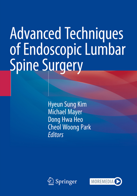 Advanced Techniques of Endoscopic Lumbar Spine Surgery - 