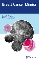 Breast Cancer Mimics - Urszula Wegner, Chitrangada Singh