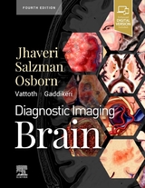 Diagnostic Imaging: Brain - Jhaveri, Miral D