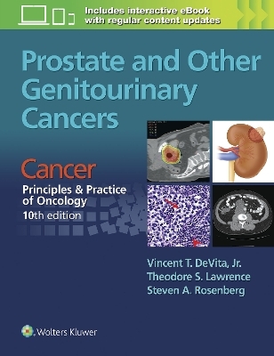 Prostate and Other Genitourinary Cancers - Vincent T DeVita  Jr., Theodore S. Lawrence, Steven A Rosenberg