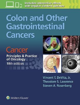 Colon and Other Gastrointestinal Cancers - 