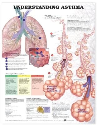 Understanding Asthma Anatomical Chart