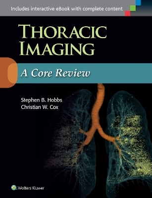 Thoracic Imaging: A Core Review - Stephen Hobbs, Christian Cox