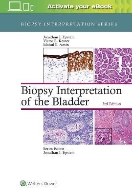 Biopsy Interpretation of the Bladder - Jonathan Epstein, Victor Reuter, Mahul B. Amin