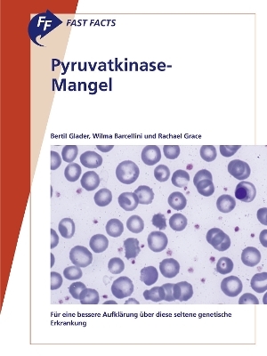 Fast Facts: Pyruvatkinase-Mangel - Bertil Glader, Wilma Barcellini, Rachael Grace